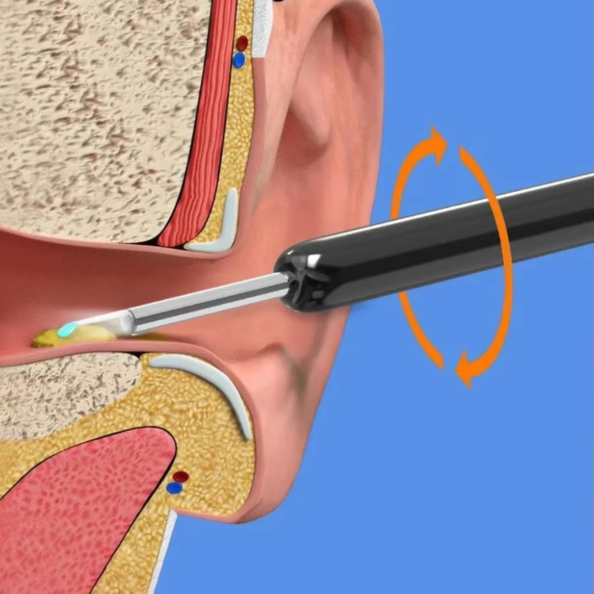 Wireless Wi-Fi Visual Ear Cleaner